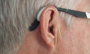 Cochlear